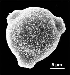 Abedul — microscopía electrónica de barrido
