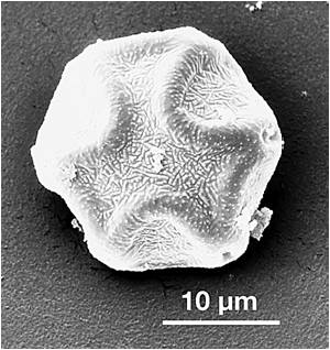 Aliso — microscopía electrónica de barrido