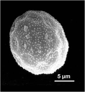 Quenopodiáceas/Amarantáceas — microscopía electrónica de barrido