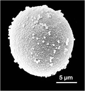 Cupresáceas/Taxáceas — microscopía electrónica de barrido