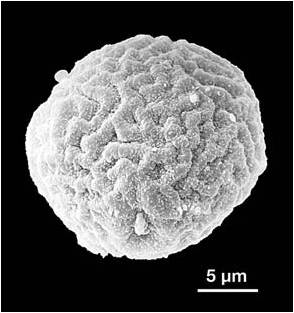 Olmos — microscopía electrónica de barrido