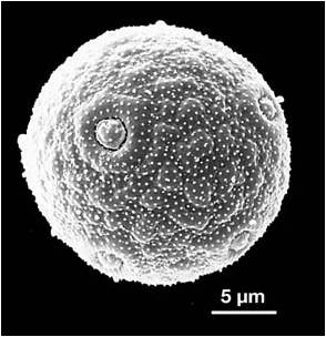 Plantain — microscopie électronique à balayage